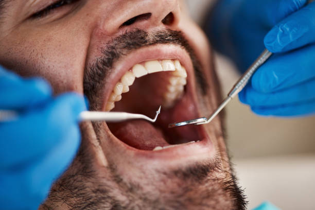 Best Emergency Dental Care for Broken or Chipped Teeth in Powhatan Point, OH